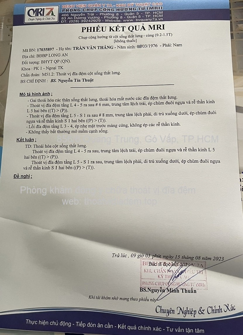 Chữa thoát vị đĩa đệm 